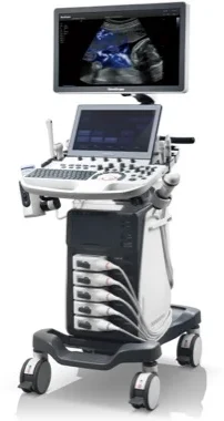 SonoScape P40 Elite